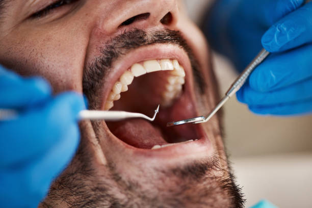 Best Emergency Dental Care for Broken or Chipped Teeth in Brownsboro, TX